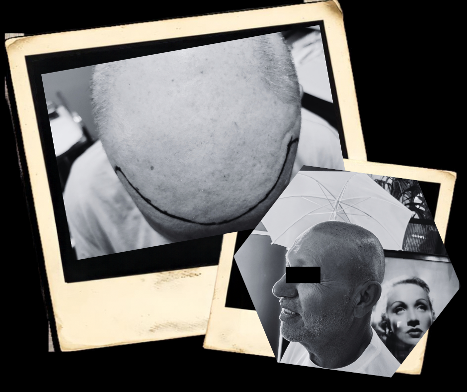 scalp micropigmentation naples Vintage Lashes and beauty Services